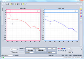 Grâce à l’option de recouvrement, vous pouvez aisément comparer et analyser les deux oreilles en même temps. Il est aussi inclus une bande passante sur 16kHz permettant une visualisation de la perte dans les hautes fréquences pour des résultats précis.