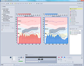 Cette fonctionnalité du logiciel vous aide grandement dans l’investigation des différences entre les tests vocaux et les fréquences que l’oreille perçoit réellement. Il vous aide également pour analyser l’écart à surmonter pour arriver à une compréhension équilibrée de la parole.